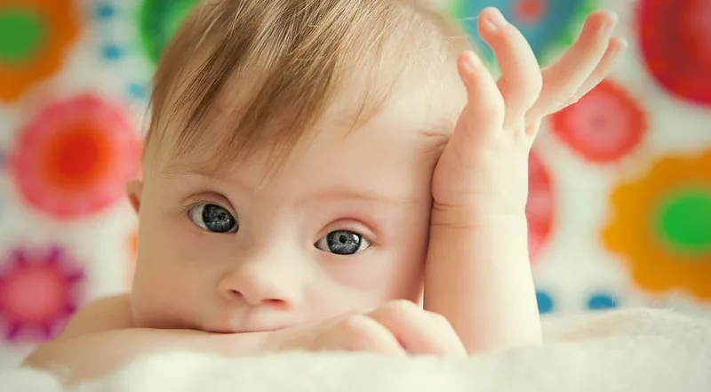 Seguros médicos para personas con síndrome de Down - JLA Asociados